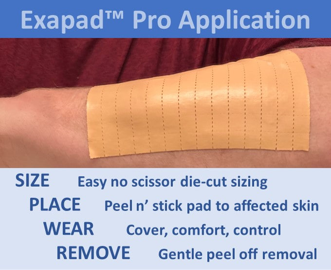New Product! Exapad(TM) Pro Large Area Psoriasis/Eczema Skin Cover, Comfort and Control Exfoliating Adhesive Medical Pad - Sample Sheet 9.75 in x 20 in